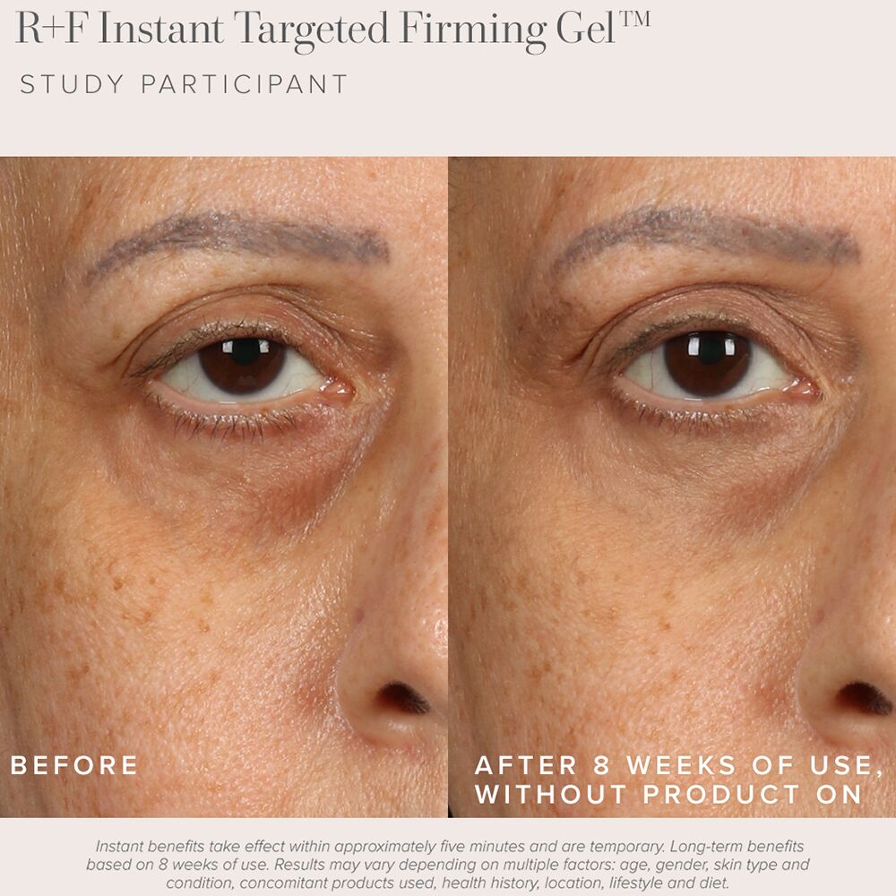 Rodan good and Fields firming gel