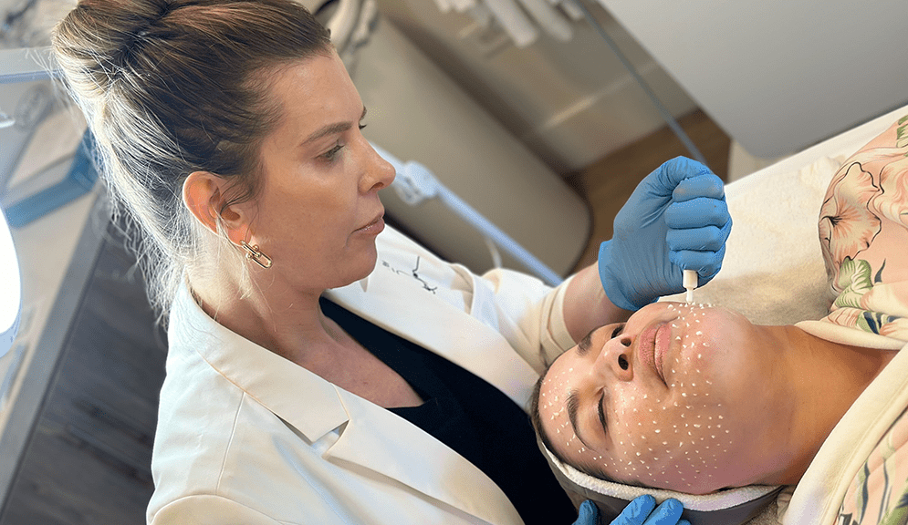 Revitalize Your Pores and skin with Liquid Microneedling