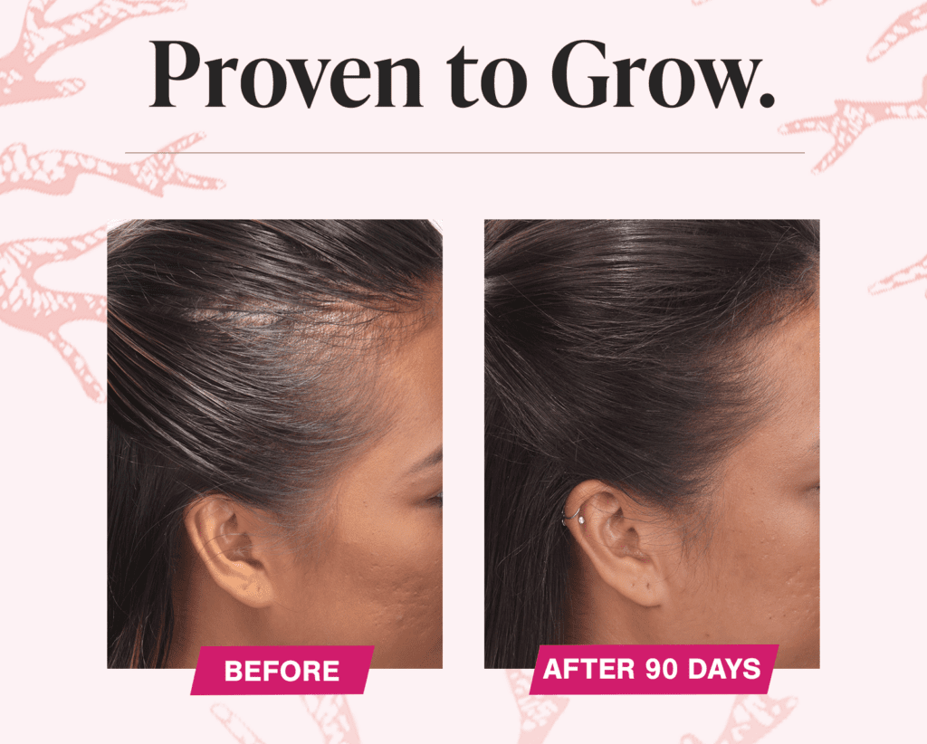 92 P.c of Ladies Noticed Thicker Hair in 3 Months Due to This Hair-Development Complement – Beauty