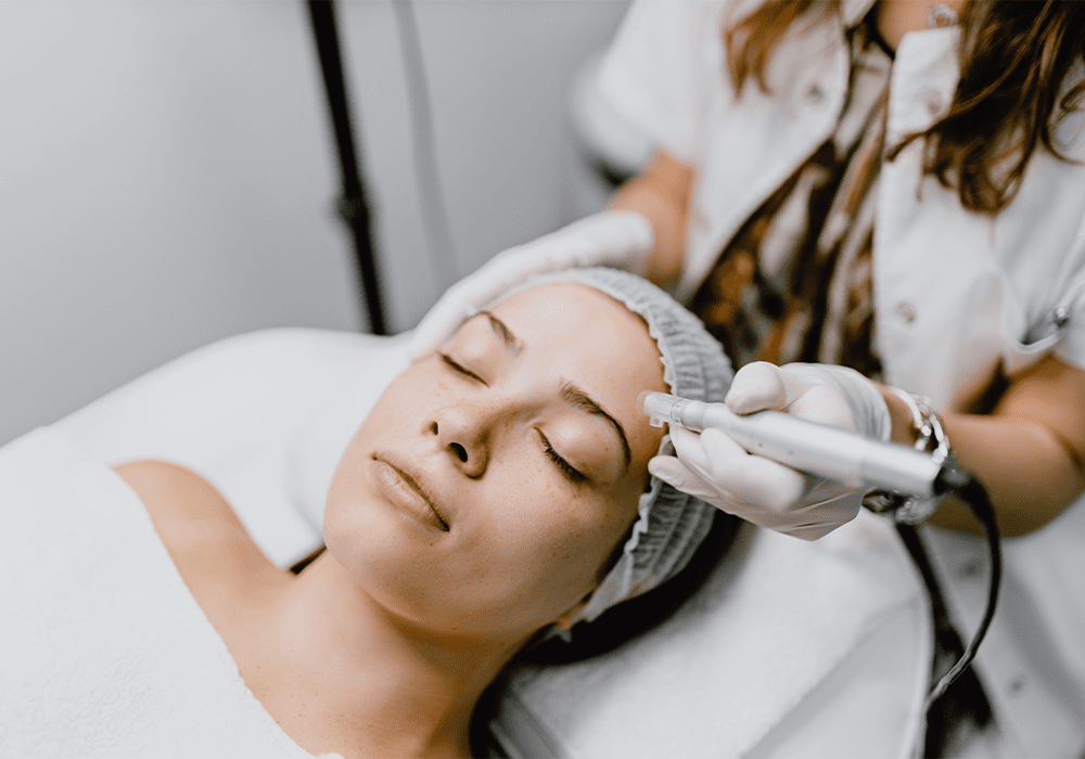 RF microneedling step 1 — creating micro-channels in Ponte Vedra, FL