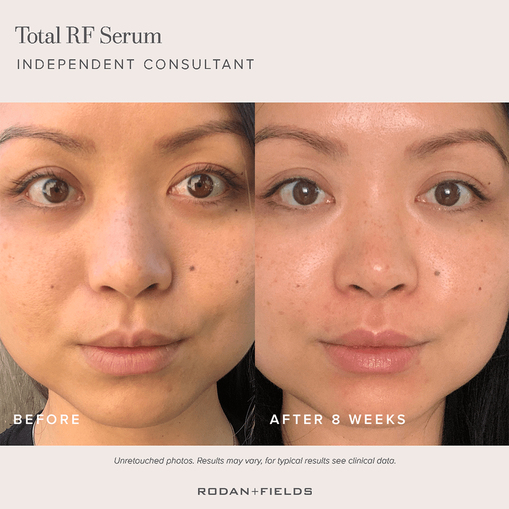 Rodan + Fields' New Multitasking Serum Is Here to Streamline