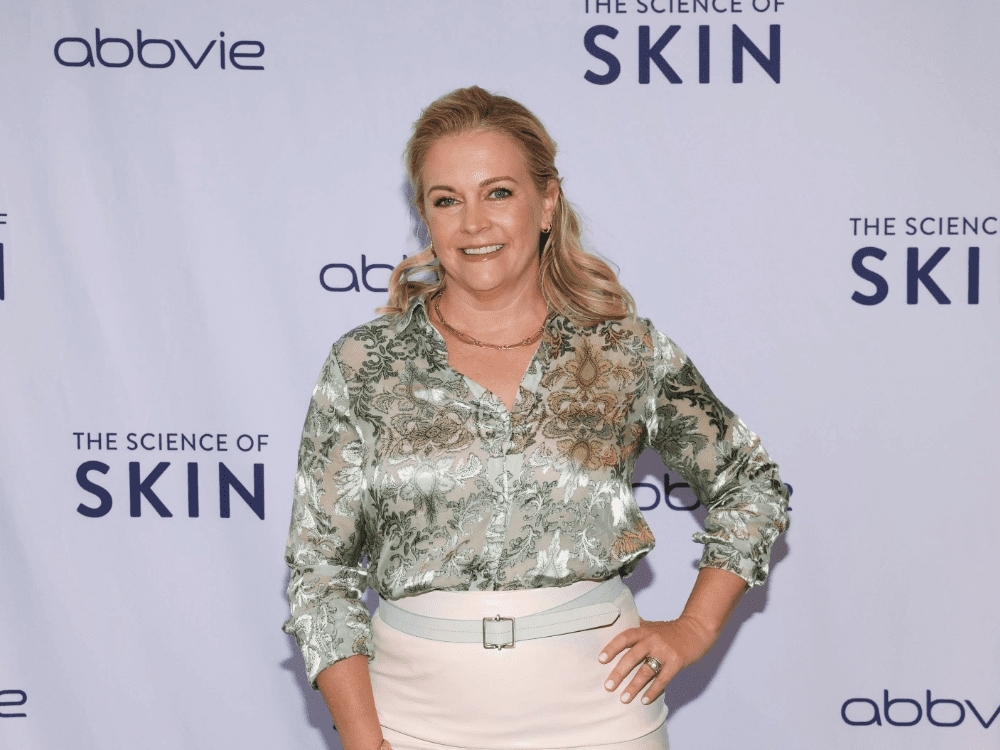 Melissa Joan Hart Talks Eczema, Beauty Regrets and More