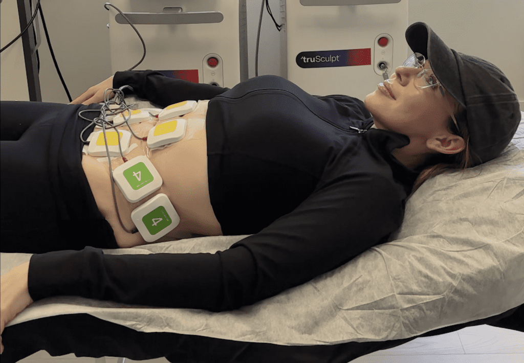 How Truflex Helped This New Mother Get Her Abs Again After Being pregnant – Beauty