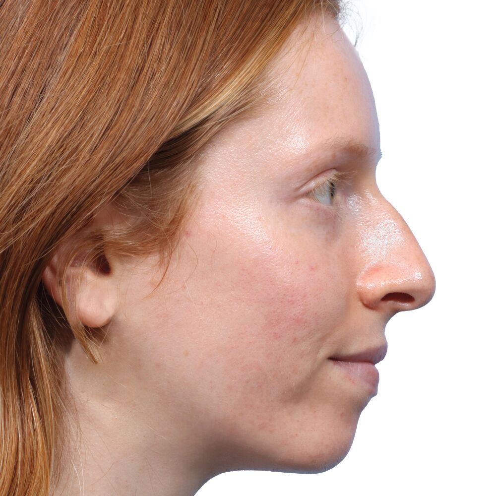 Sufferers and Medical doctors Share Their Confidence-Boosting Procedures
