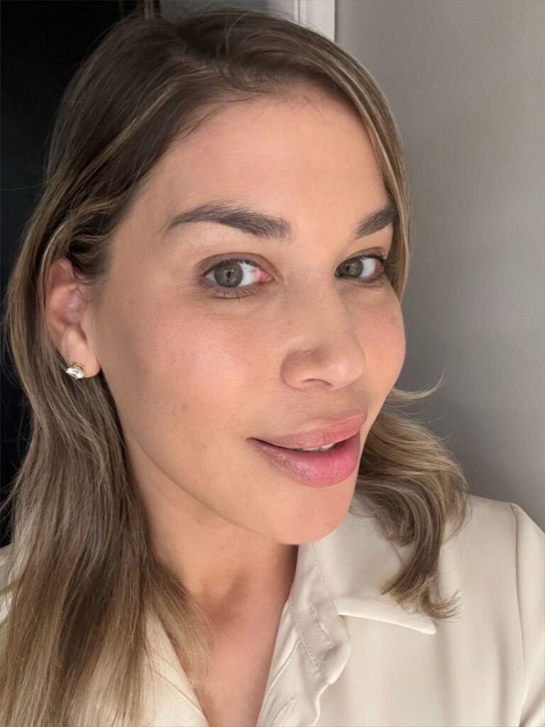 Tatiana post-laser
