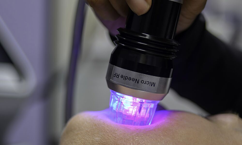FDA Cautions on Risks of RF Microneedling for Skin Care