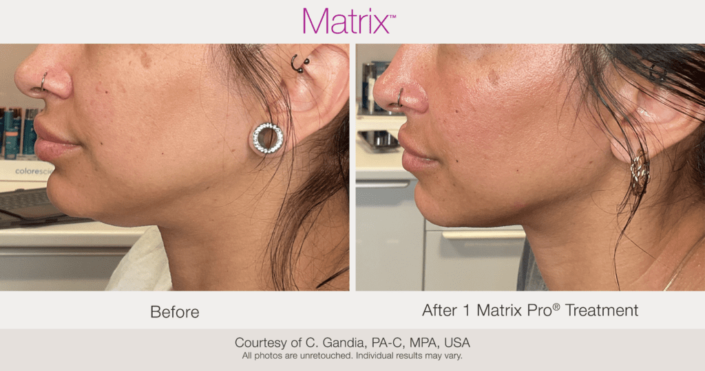 BA Matrix CGandia 1Tx 031 1